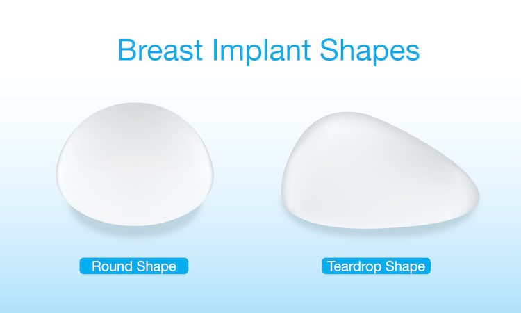 breast implant shapes