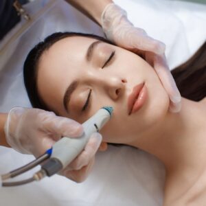 Woman receiving microneedling treatment